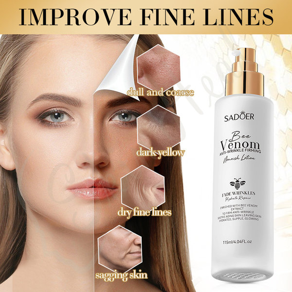 Bee-Venom-Anti-Wrinkle-Before-After-Sadoer