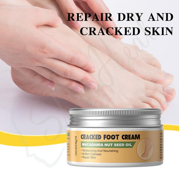 Macadamia-Nut-Oil-Cracked-Foot-Cream-Skin-Repair-Kormesic