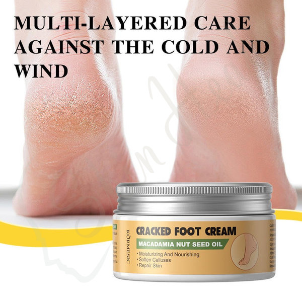 Macadamia-Nut-Oil-Cracked-Foot-Cream-Two-Feet-Kormesic